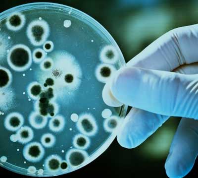 Μικροβιακή Βιοτεχνολογία (Microbial Biotechnology)